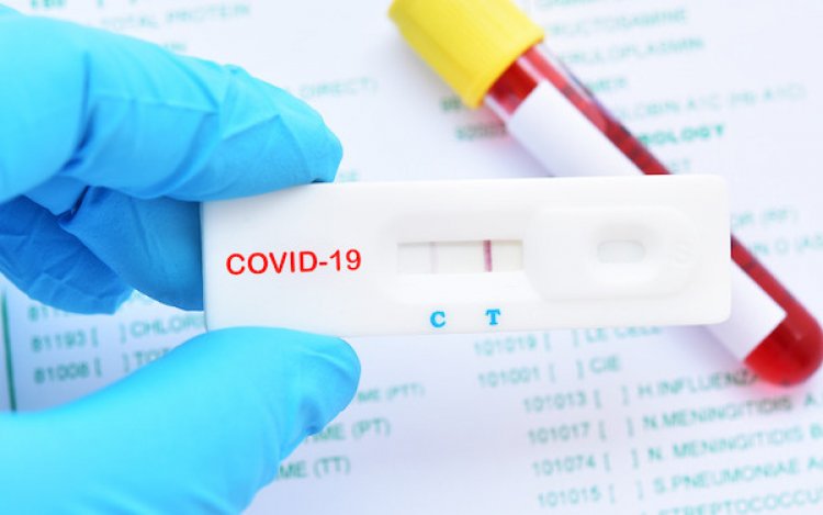 COVID-19: Nigeria Confirmed Cases Hits 65,305 and 157 New Cases Recorded