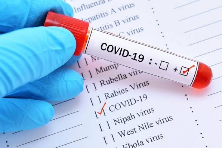 COVID-19: Nigeria Records 474 New Cases, Total Now 70,699