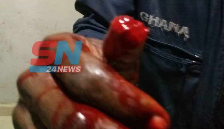 Suspect bites off police officer's thumb at Kasoa Millennium City
