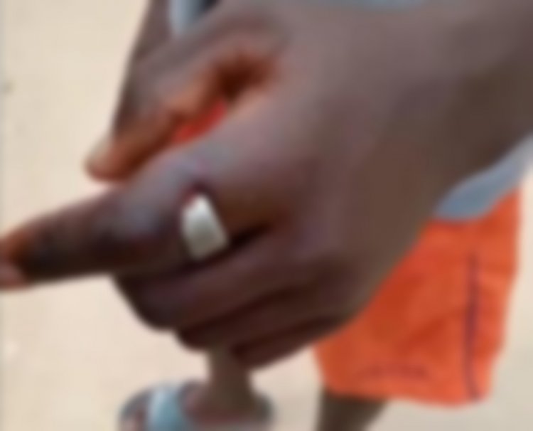 Boy, sadly losing finger after wearing friend’s sakawa ring