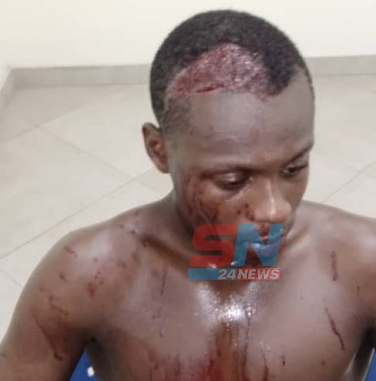 Man allegedly hires thugs to inflict cutlass wounds on Mother, Son at Kasoa