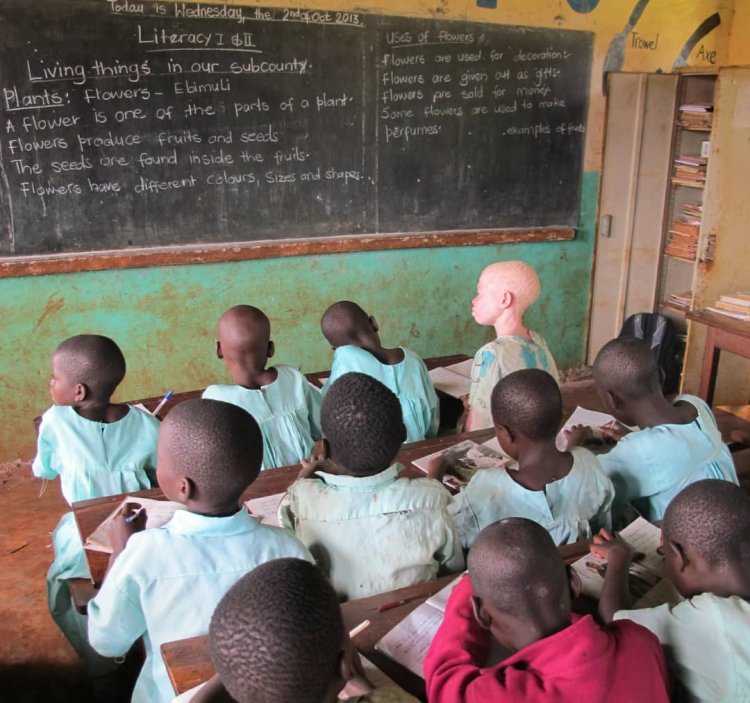 Albino Students to sit closer to Teaching Boards: Albino's Association of Ghana 