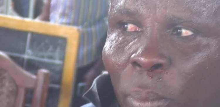 Adongo Boys Attack Koforidua PROTOA Station, One in Coma, 4 Injured 