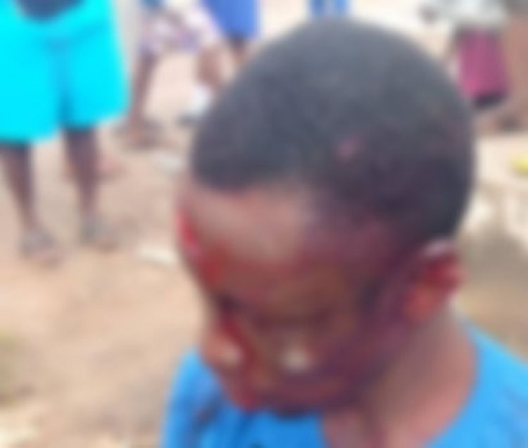 Residents Subjected Thieves to Brutalities, One Dead, Other Begs For Bread and Porridge 