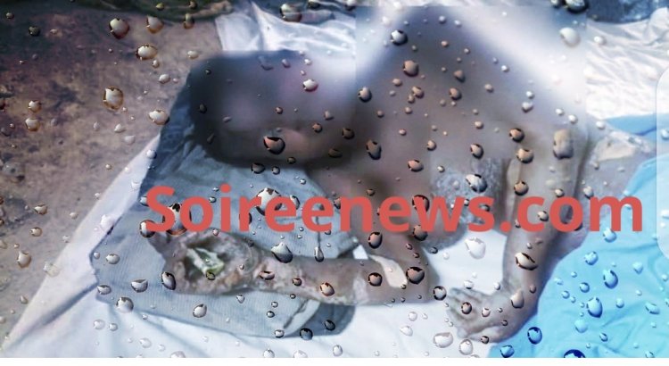 Breast of a lady set ablaze at Kotwi Left to rot