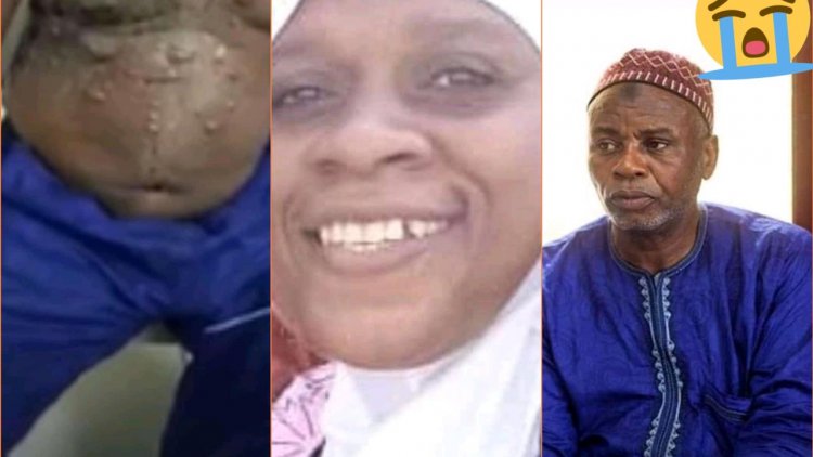 A Great Mallam Dies After The Wife Poured Acid On Him For Refusing To Divorce Her