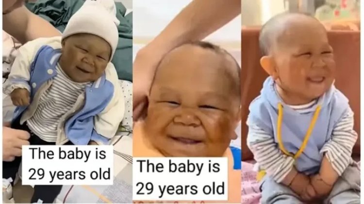 29 Year Old Man Who Remains A Baby  Due To Rare Medical Condition