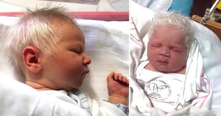 Mom Becomes Speechless After Baby  Was Born With White Hair