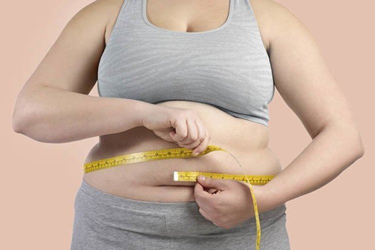 Having a big stomach is not life-threatening – Plastic surgery consultant