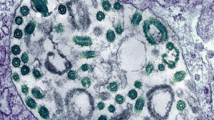 Ghana reports two suspected Marburg virus  cases