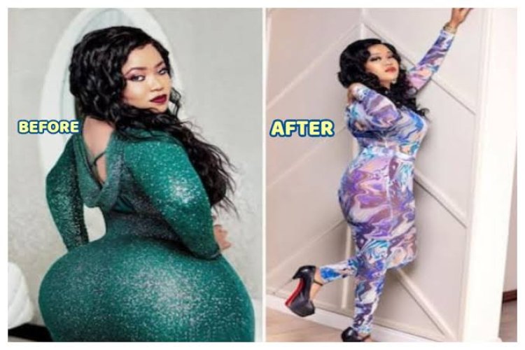 ‘I’m Lucky To Be Alive’ – Vera Sidika Warn Ladies To Desist From Undergoing ‘Butt Surgery’