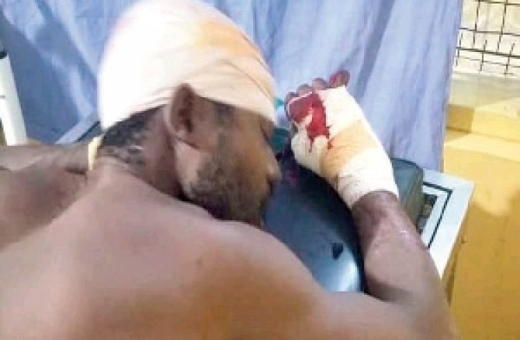 Man,32, battle for life after being butchered over stolen plantain