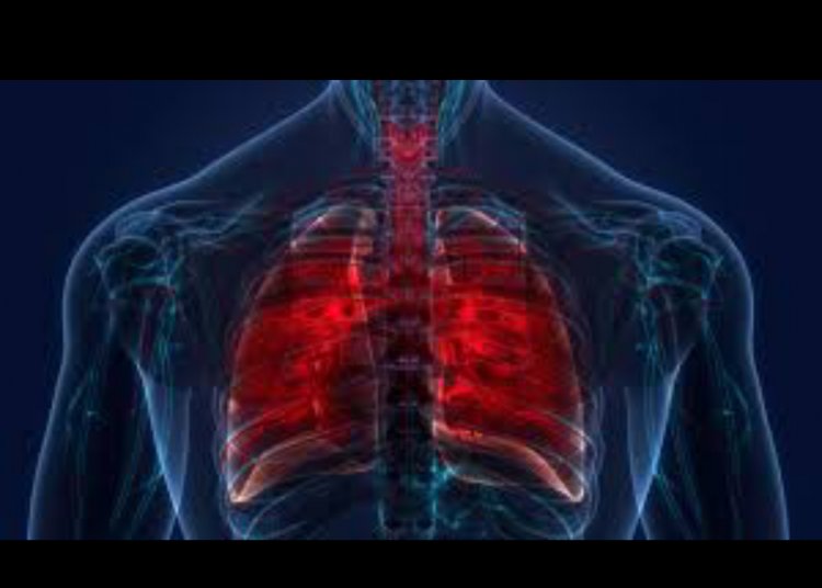 30 people die daily from tuberculosis in Ghana