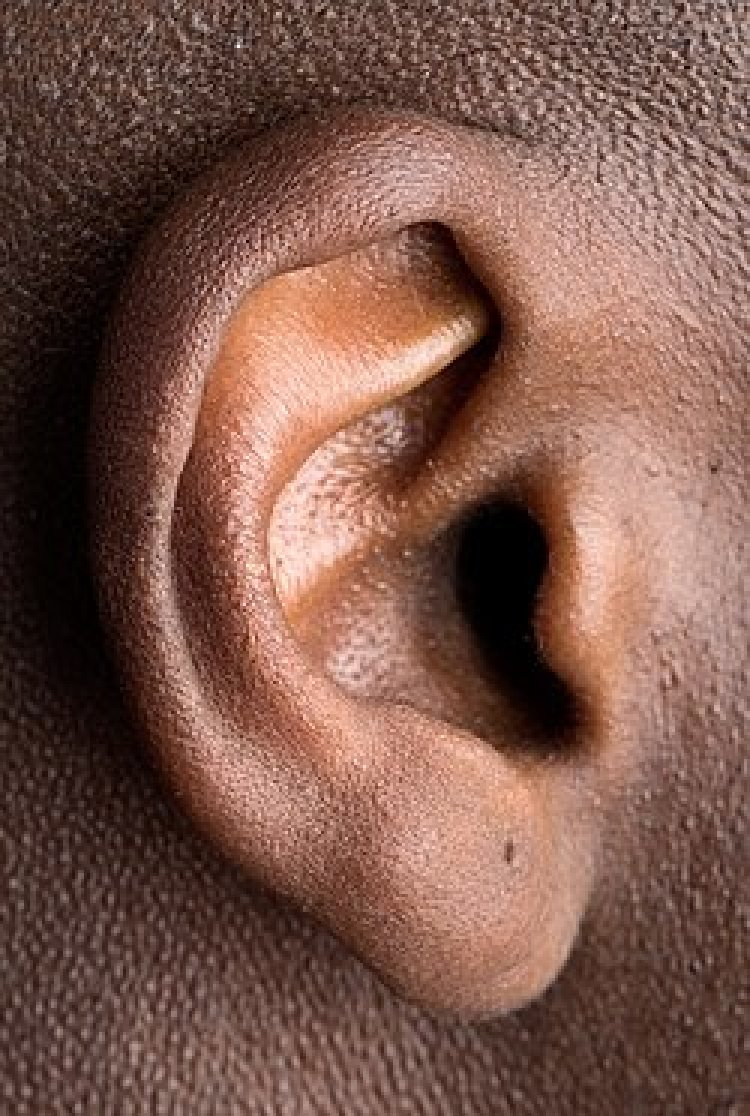 We must Avoid the insertion of objects into our ears - ENT nurse specialist advises