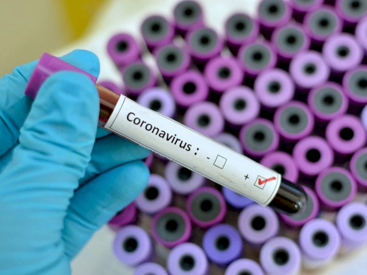 Chloroquine Found Effective Against Coronavirus, Cures 12,552 Patients In China