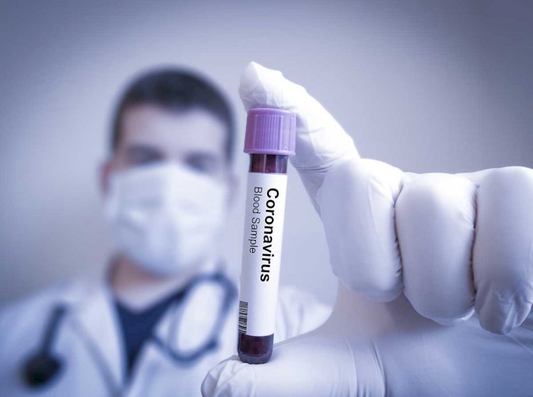 Coronavirus in Africa: The Facts About the Origin, Symptoms and Cure You Need to Know.