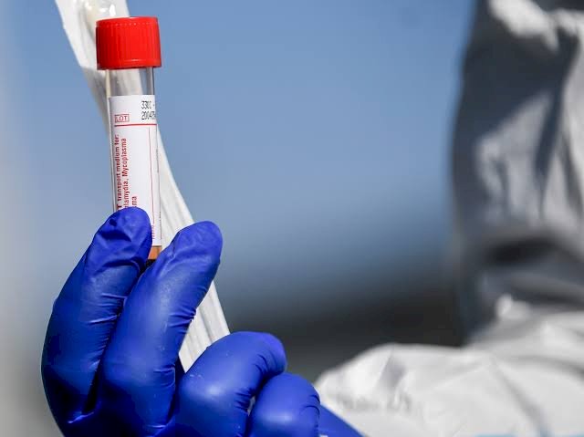 Coronavirus: Nigeria Tally Leaps To 288, 14 New Cases Confirmed
