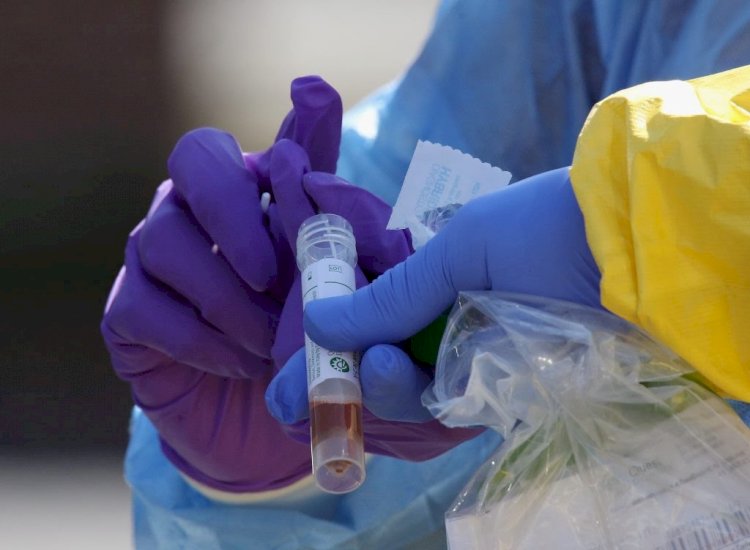 Coronavirus: Nigeria's Confirmed Cases Hits 323