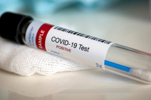 Covid-19:  1,982 Backlog Samples Cleared, Ghana’s Infection Rate to be Determined Daily