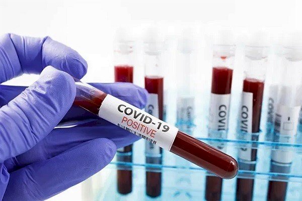 COVID-19: Ghana records 54 new infections; active cases rise